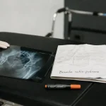 Radiographie pour fracture branche ischio pubienne, diagnostic et traitement